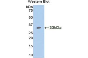 Western blot analysis of the recombinant protein. (ANGPTL4 antibody  (AA 183-401))