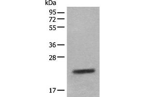 Western blot analysis of Mouse eye tissue lysate using CRYGS Polyclonal Antibody at dilution of 1:800