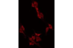 ABIN6274946 staining HT29 by IF/ICC. (CAGE1 antibody  (C-Term))