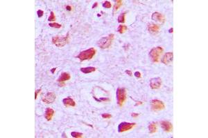 Immunohistochemical analysis of EIF5B staining in human brain formalin fixed paraffin embedded tissue section. (EIF5B antibody  (C-Term))