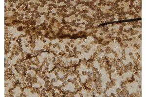 ABIN6277016 at 1/100 staining Mouse brain tissue by IHC-P. (Cbl Proto-Oncogene B, E3 Ubiquitin Protein Ligase (CBLB) (N-Term) antibody)