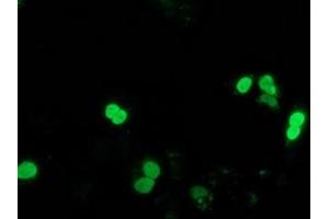 Image no. 2 for anti-Synovial Sarcoma, X Breakpoint 1 (SSX1) antibody (ABIN1501157) (SSX1 antibody)
