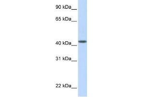 WB Suggested Anti-DENND1B Antibody Titration: 0. (DENND1B antibody  (N-Term))