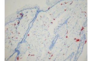 Image no. 1 for anti-Macrophages antibody (ABIN481694) (Macrophages antibody)