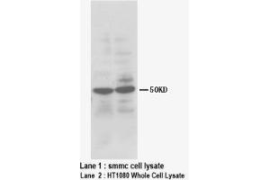 Image no. 1 for anti-Heparanase (HPSE) (N-Term) antibody (ABIN1495120) (HPSE antibody  (N-Term))