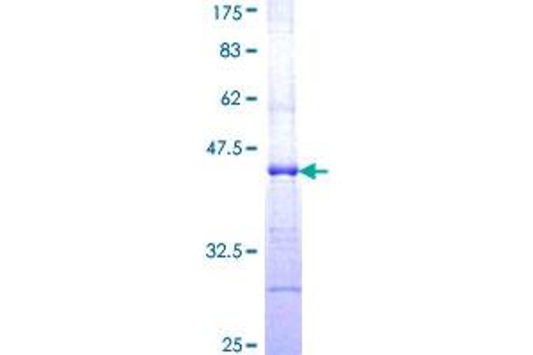 CLPTM1 Protein (AA 151-251) (GST tag)