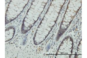 Immunoperoxidase of monoclonal antibody to CLIC1 on formalin-fixed paraffin-embedded human colon. (CLIC1 antibody  (AA 1-241))