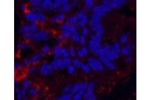 Immunofluorescence analysis of Mouse colon tissue using KIF7 Monoclonal Antibody at dilution of 1:200. (KIF7 antibody)