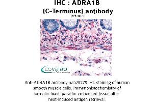 Image no. 1 for anti-Adrenergic, alpha-1B-, Receptor (ADRA1B) (C-Term), (Cytoplasmic Domain) antibody (ABIN1731575) (ADRA1B antibody  (C-Term, Cytoplasmic Domain))