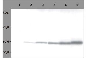 Western Blotting (WB) image for anti-Tubulin, beta (TUBB) antibody (ABIN93914)