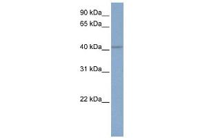 KCNN4 antibody used at 1 ug/ml to detect target protein. (KCNN4 antibody  (C-Term))