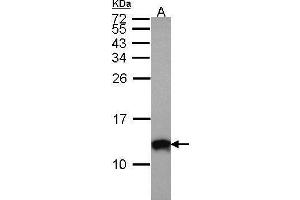 WB Image Sample (30 ug of whole cell lysate) A: A431 , 15% SDS PAGE antibody diluted at 1:1000 (S100A10 antibody)