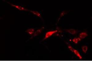 ABIN6278583 staining  HuvEc cells by IF/ICC. (IP6K2 antibody  (Internal Region))