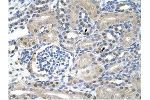 NXF1 antibody was used for immunohistochemistry at a concentration of 4-8 ug/ml to stain Epithelial cells of renal tubule (arrows) in Human Kidney.