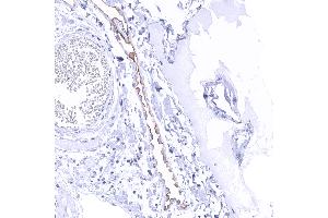 Distinct Upk3b immunostaining of apical membranes of peritoneal mesothelial cells (Uroplakin 3B antibody)
