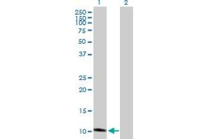 Western Blot analysis of GHRH expression in transfected 293T cell line by GHRH MaxPab polyclonal antibody.