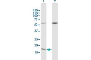Western Blot analysis of PDCD5 expression in transfected 293T cell line by PDCD5 MaxPab polyclonal antibody. (PDCD5 antibody  (AA 1-125))