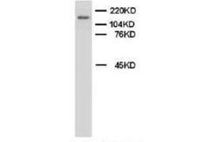 Western blot analysis of rat brain tissue lysis using Myeloperoxidase antibody (Myeloperoxidase antibody  (C-Term))