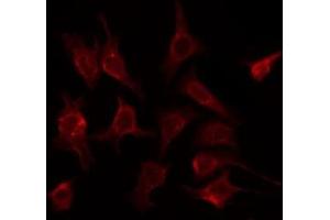 ABIN6275726 staining HeLa by IF/ICC. (CREB3L2 antibody  (Internal Region))