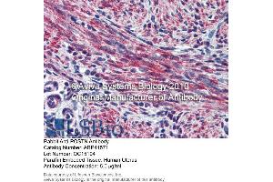 Immunohistochemistry (IHC) image for anti-Periostin (POSTN) (Middle Region) antibody (ABIN2776883) (Periostin antibody  (Middle Region))