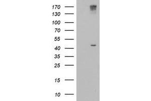HEK293T cells were transfected with the pCMV6-ENTRY control (Left lane) or pCMV6-ENTRY AGPAT5 (Right lane) cDNA for 48 hrs and lysed. (AGPAT5 antibody)