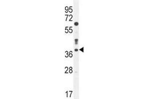 Caspase-3 antibody western blot analysis in MDA-MB435 lysate (Caspase 3 antibody  (AA 219-248))