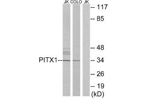 Western blot analysis of extracts from Jurkat cells and COLO cells, using PITX1 antibody.