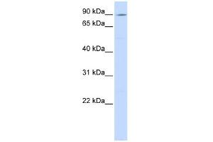 WB Suggested Anti-ATP2C1 Antibody Titration:  0. (ATP2C1 antibody  (C-Term))
