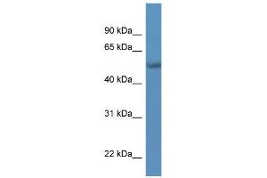 WB Suggested Anti-TADA2L Antibody Titration:  0. (TADA2L antibody  (C-Term))