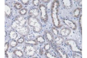 DAB staining on IHC-P; Samples: Human Kidney Tissue (ICA1 antibody  (AA 1-258))
