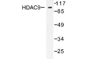 Image no. 2 for anti-Histone Deacetylase 9 (HDAC9) antibody (ABIN265461)