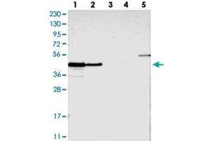 Western blot analysis of Lane 1: RT-4, Lane 2: U-251 MG, Lane 3: Human Plasma, Lane 4: Liver, Lane 5: Tonsil with PAWR polyclonal antibody  at 1:250-1:500 dilution.