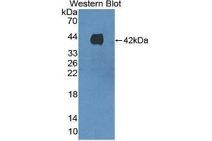 Detection of Recombinant Kim1, Porcine using Polyclonal Antibody to Kidney Injury Molecule 1 (Kim1) (HAVCR1 antibody  (AA 5-107))