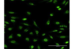 Immunofluorescence of monoclonal antibody to NBEA on HeLa cell. (Neurobeachin antibody  (AA 1133-1220))