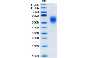 B7-H6 Protein (AA 25-262) (His tag)