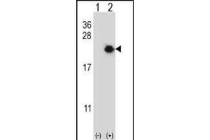 Western blot analysis of EIF4EBP1 (arrow) using rabbit polyclonal EIF4EBP1 Antibody (Center) (ABIN656558 and ABIN2845820). (eIF4EBP1 antibody  (AA 31-61))