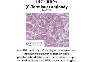 Image no. 1 for anti-Retinol Binding Protein 1, Cellular (RBP1) (C-Term) antibody (ABIN1738770) (RBP1 antibody  (C-Term))