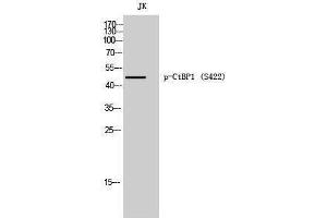 Western Blotting (WB) image for anti-C-terminal Binding Protein 1 (CTBP1) (pSer422) antibody (ABIN3182694) (CTBP1 antibody  (pSer422))