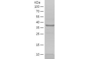 Western Blotting (WB) image for Secreted and Transmembrane 1 (SECTM1) (AA 69-248) protein (His-IF2DI Tag) (ABIN7282719) (SECTM1 Protein (AA 69-248) (His-IF2DI Tag))