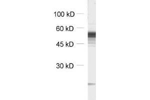 GABRB3 Antikörper  (AA 344-429)