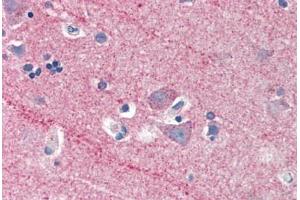 Human Brain, Cortex (formalin-fixed, paraffin-embedded) stained with ICAM5 antibody ABIN337181 at 5 ug/ml followed by biotinylated anti-goat IgG secondary antibody ABIN481715, alkaline phosphatase-streptavidin and chromogen. (ICAM5 antibody  (AA 909-920))
