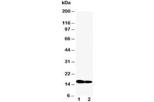 Western blot testing of IFITM1 antibody and Lane 1:  SW620 (IFITM1 antibody  (N-Term))