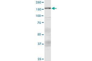 Western Blotting (WB) image for anti-Additional Sex Combs Like 1 (ASXL1) (AA 1-84) antibody (ABIN792966) (ASXL1 antibody  (AA 1-84))