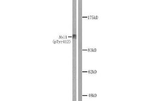 Western blot analysis of extracts from COS7 cells treated with Adriamycin. (ABL1 antibody  (pTyr412))