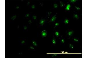 Immunofluorescence of monoclonal antibody to ZIC4 on HeLa cell. (ZIC4 antibody  (AA 249-319))