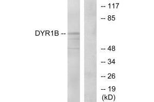 Western blot analysis of extracts from Jurkat cells, using DYR1B antibody. (DYRK1B antibody)