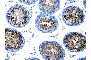 IHC analysis of DDX4 using anti-DDX4 antibody (ABIN7601203). (DDX4 antibody  (AA 3-666))