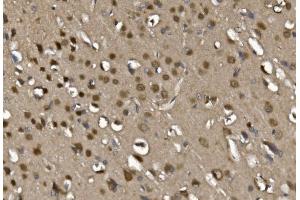 IHC analysis of MEF2C using anti-MEF2C antibody (ABIN6719606). (MEF2C antibody)