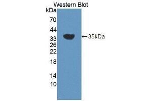 Detection of Recombinant ERRb, Mouse using Polyclonal Antibody to Estrogen Related Receptor Beta (ERRb) (ESRRB antibody  (AA 166-438))
