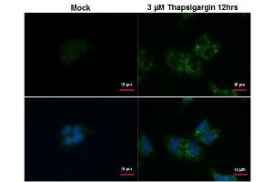 ICC/IF Image SQSTM1 antibody [N3C1], Internal detects SQSTM1 protein at autophagosome by immunofluorescent analysis. (SQSTM1 antibody)